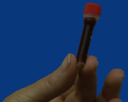 Imagem de Bio-Tubes: Kit de colheita de sangue
