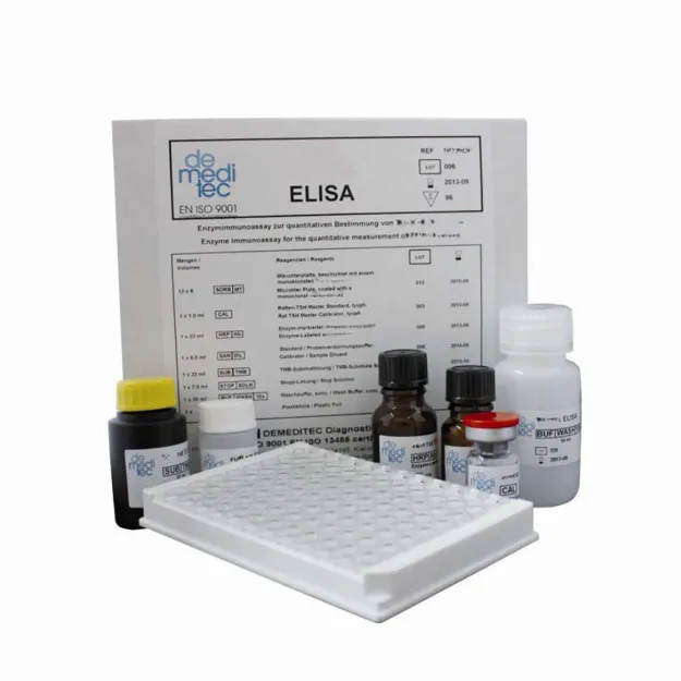 Imagem de Toxoplasma gondii IgM µ-capture ELISA